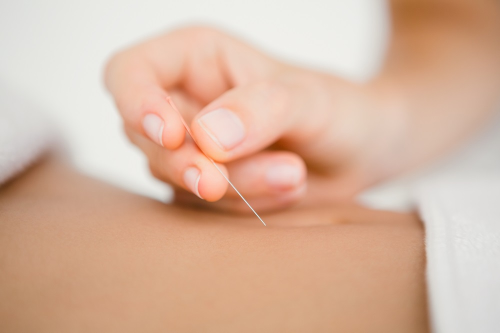 dry needling